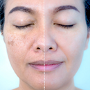 Dermachem Kit Skincare Clareador e Anti-idade