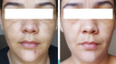 Kit Clareador Vitamina C Skincare Anti-idade Sérum Protetor Facial
