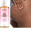 Óleo de Rosa Mosqueta Selvagem Corporal Reduz Estrias Estimula o Colágeno De 120ML