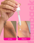 Sérum Clareador Íntimo