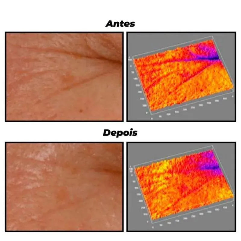 Creme de Tratamento Anti-Idade Intensivo Creamy Retinol 30g